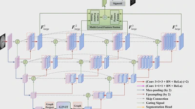 G2ViT: Graph neural network-guided vision transformer enhanced network for retinal vessel and coronary angiograph segmentation featured image