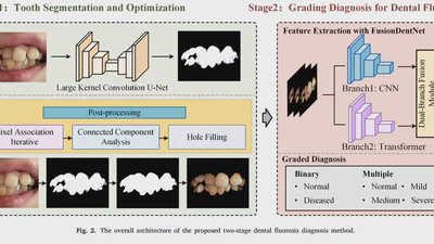 Integrated method for grading diagnosis of dental fluorosis combined with segmentation and classification featured image