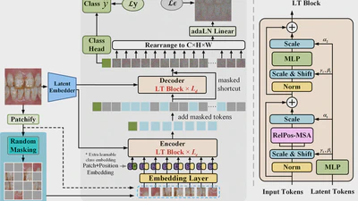 Masked latent transformer with random masking ratio to advance the diagnosis of dental fluorosis featured image