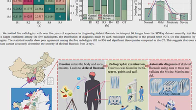 Convolutional state space model with multi-window cross-scan to advance the automated diagnosis of skeletal fluorosis featured image